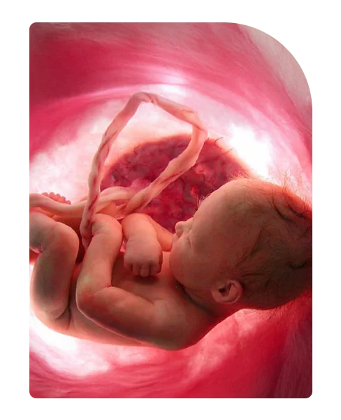 Best Fertility & IVF Treatment in Chennai